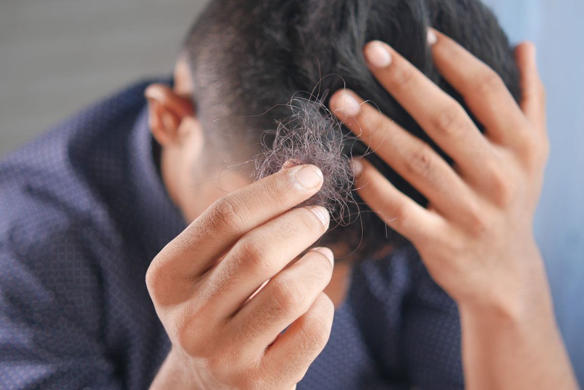 Is Hair Loss Caused by Diabetes?
