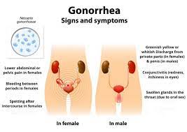 What Are the Gonorrhea?