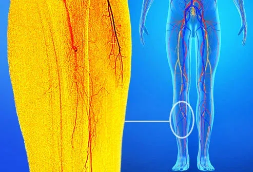 Common Causes of Pain in the Left Leg