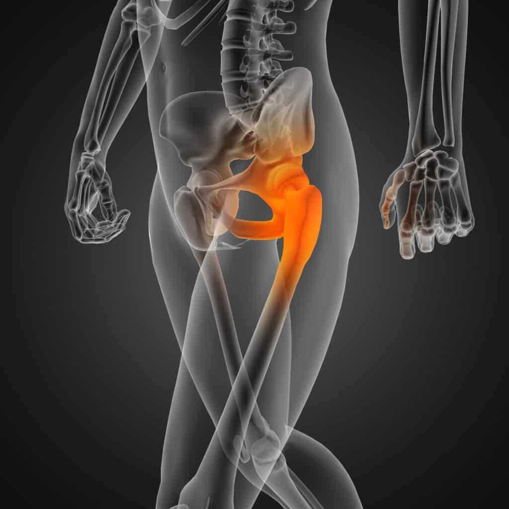 Pain in Buttocks Shooting Down Leg