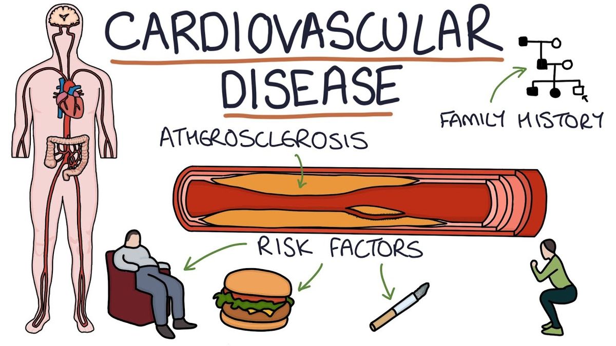Cardiovascular Disease in Africa