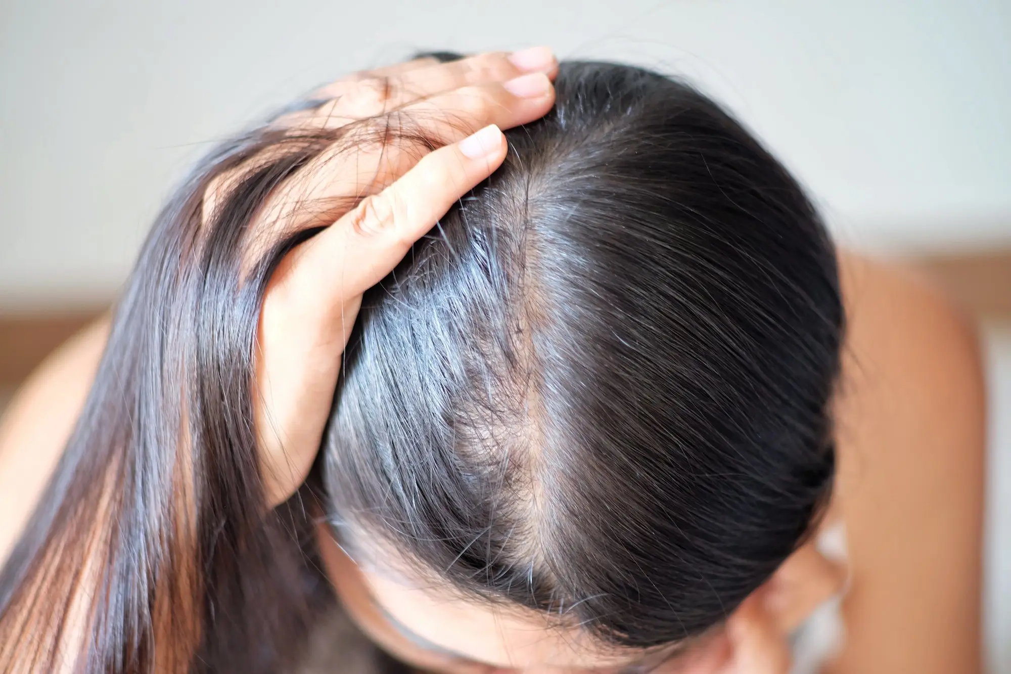Female Hair Loss and the Social Stigma That Goes With It