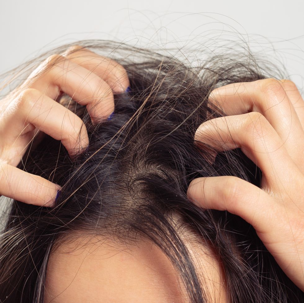 Itchy Scalp and Hair Loss - Are They Related?