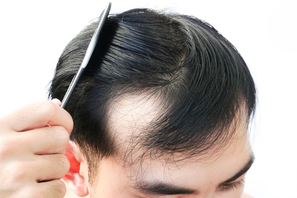 Thinning Hair Men Febron Review