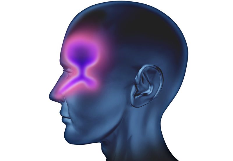 Sinus Headache Causes and How to Spot Them