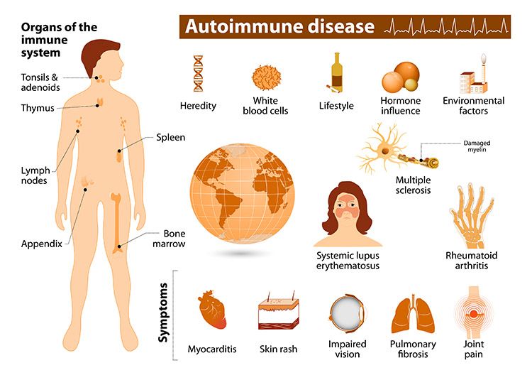 Types of Autoimmune Disease